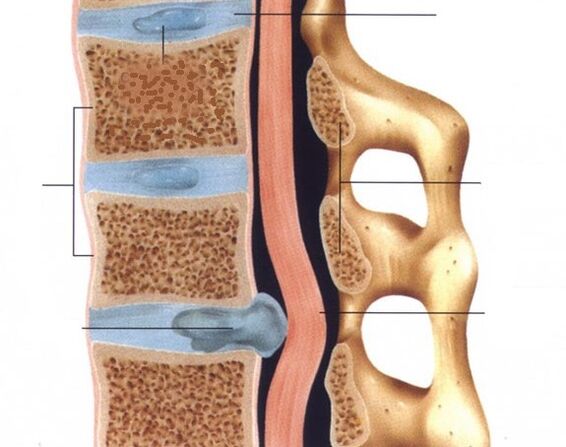 A na-akpọ hernias