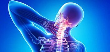 na-akpata osteochondrosis cervical