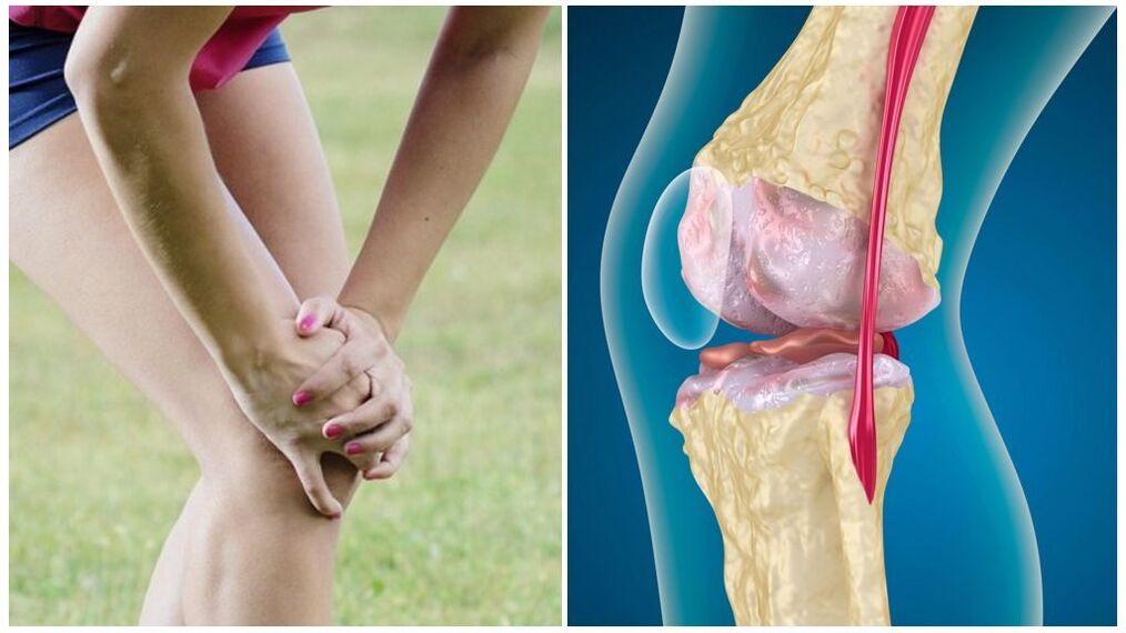 Mgbaàmà nke akpịrị