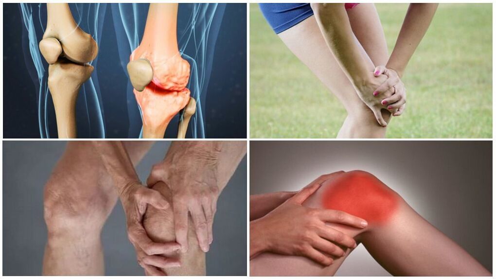 Sterations nke akpịrị