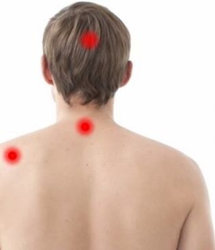 Ebe ihe mgbu na osteochondrosis cervical
