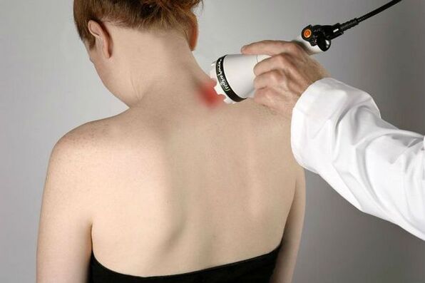 Ọkpụkpụ anụ ahụ maka ọgwụgwọ nke osteochondrosis cervical
