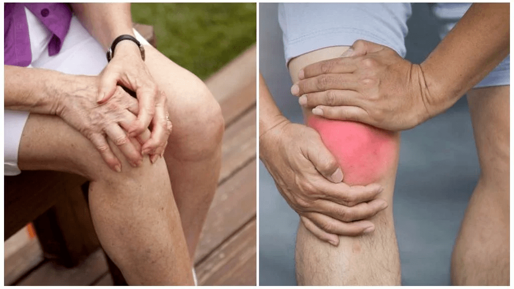 ọgwụgwọ arthrosis
