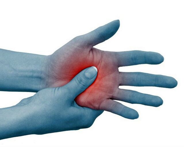 Ihe mgbu siri ike na nkwonkwo mkpịsị aka, na-ebelata site na mmega ahụ, bụ ihe ịrịba ama nke ọrịa ogbu na nkwonkwo rheumatoid.
